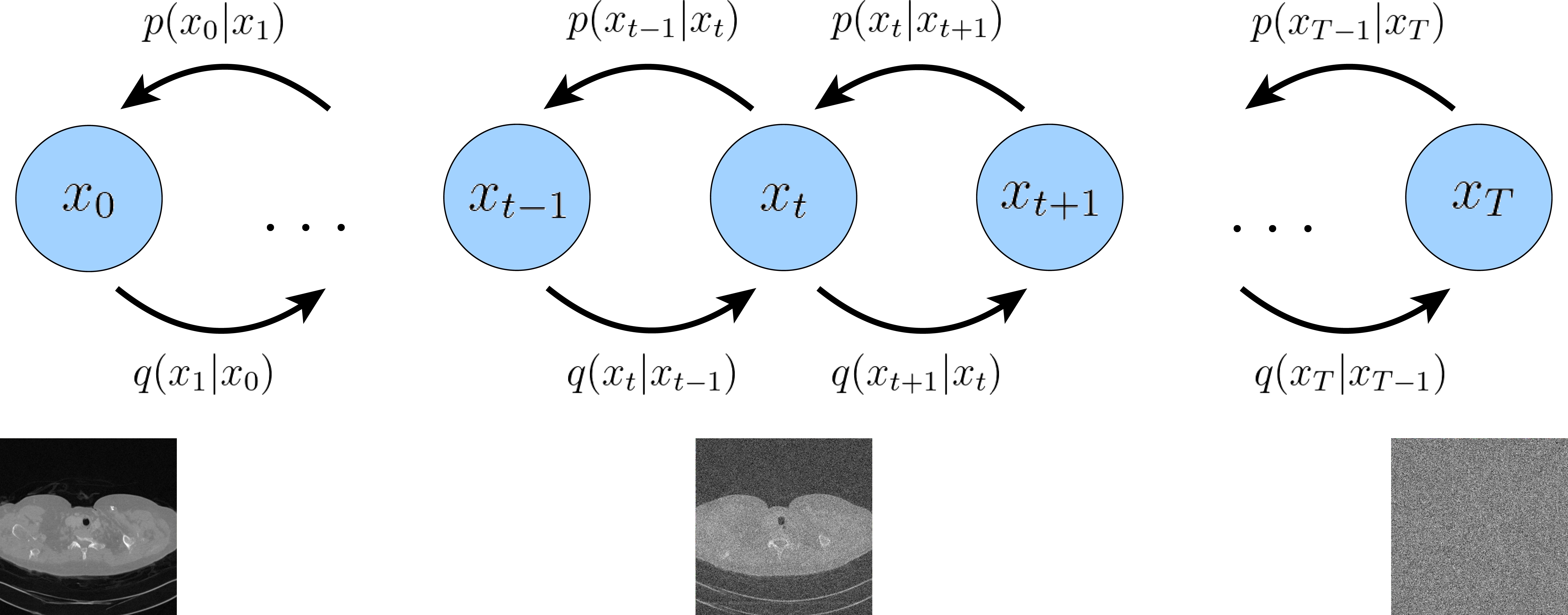 PC-POCS sampler to reconstruct a low-dose computer tomography image consistent with both the prior and the measurements